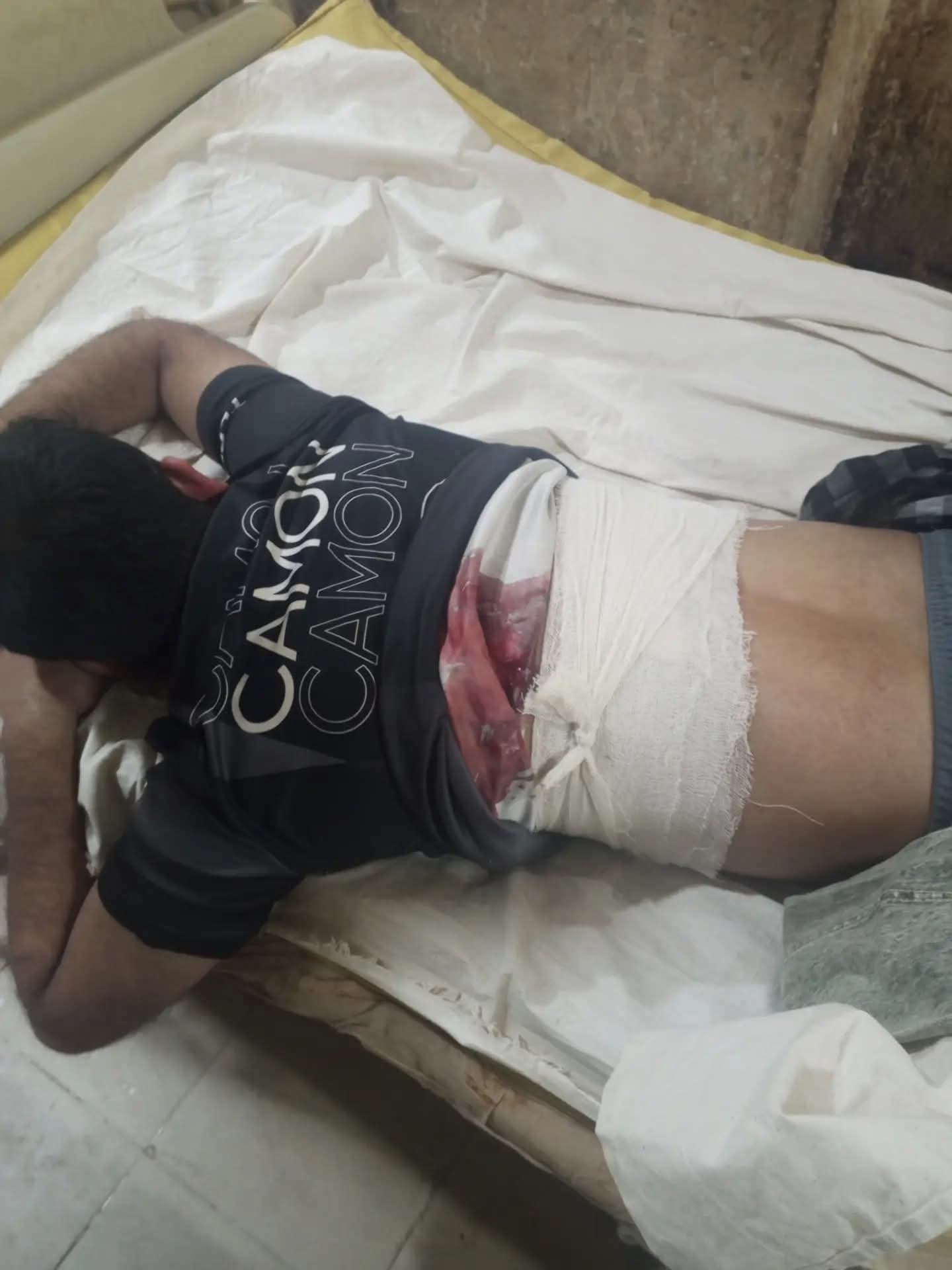 নোয়াখালীতে ব্যবসায়ীকে গুলি করে মোটরসাইকেল ছিনতাই।