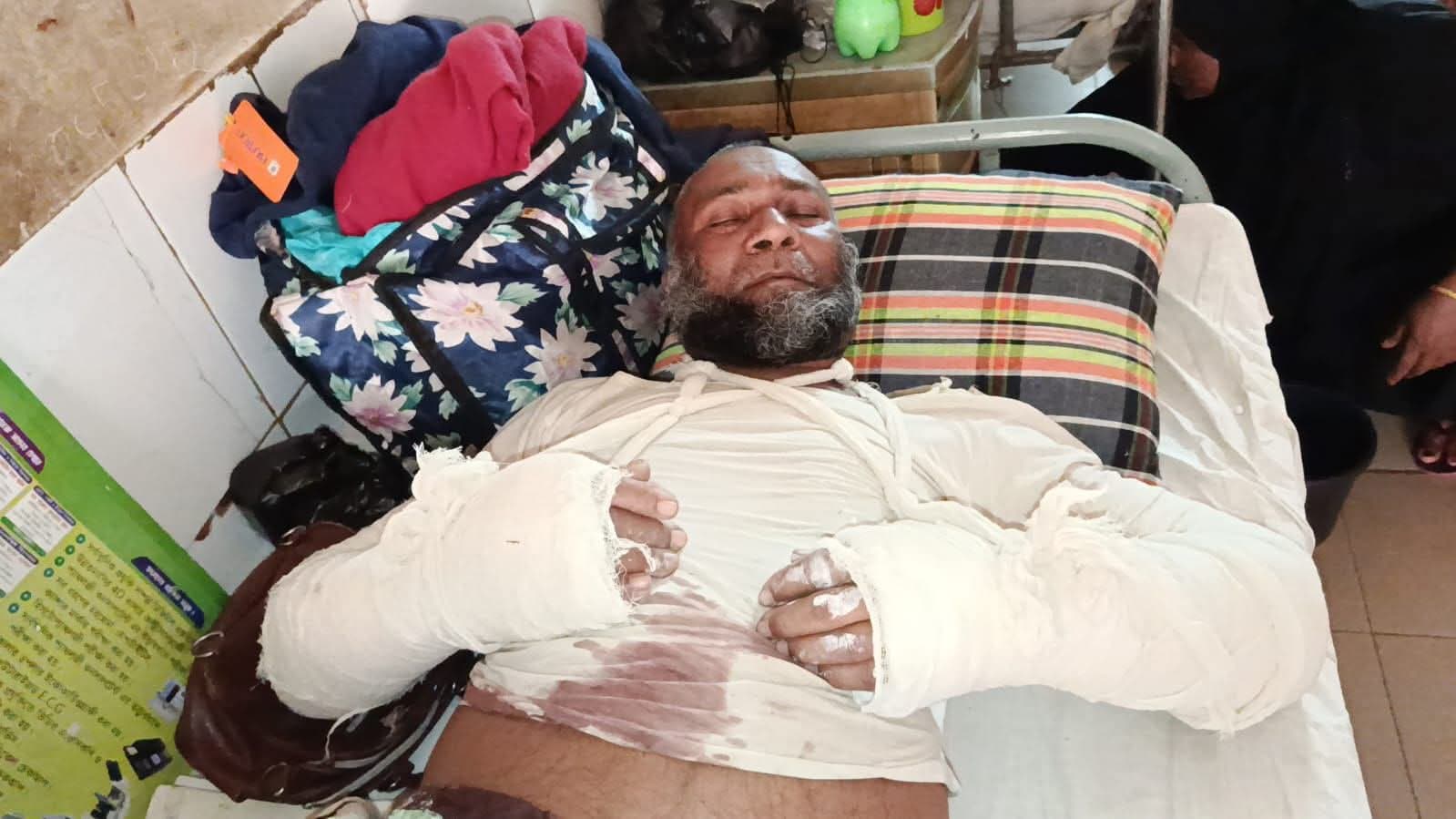 নোয়াখালী সুবর্ণচরে ২ হাত ভেঙ্গে জিন্দা কবর দেয়ার চেষ্টার অভিযোগ